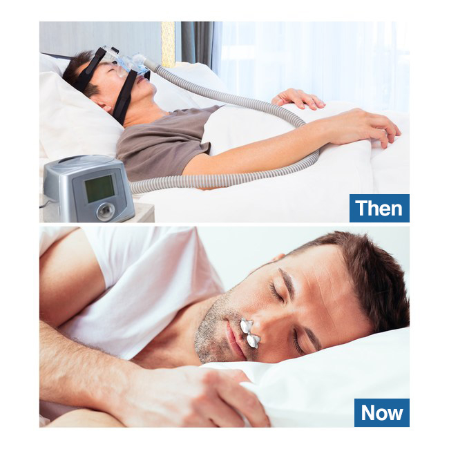 Bongo EPAP Sleep Apnea Breathing Device